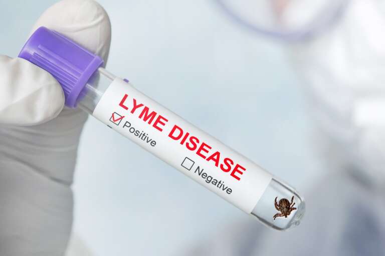 Lyme disease vaccine by Valneva up for final stage clinical trials￼