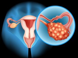 Merck and AstraZeneca pull ovarian cancer drug Lynparza as death fears surround PARP inhibitor