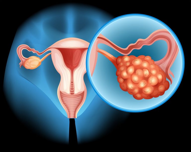 Merck and AstraZeneca pull ovarian cancer drug Lynparza as death fears surround PARP inhibitor