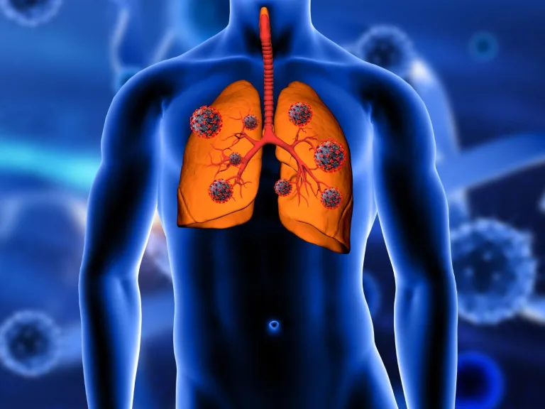 Noah Medical Raises $150 Million in Funding for Robotic Lung Surgery System and Faces Legal Battle