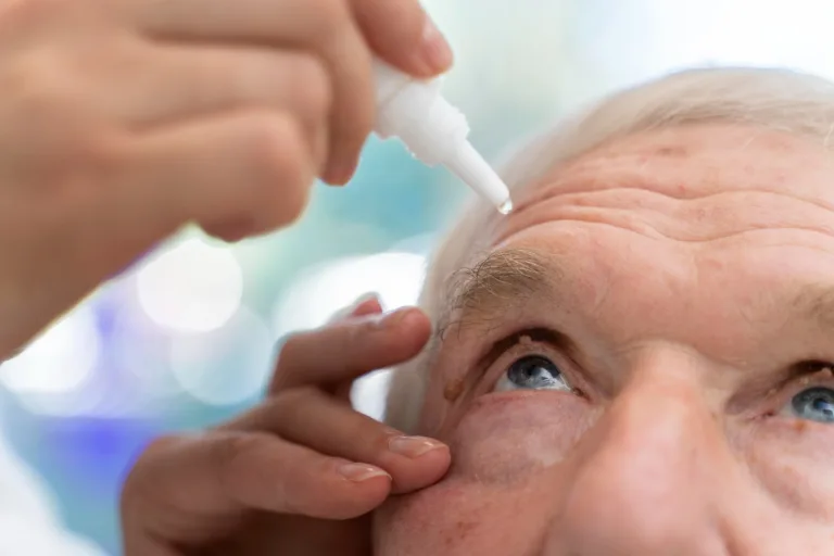 Aldeyra’s allergic conjunctivitis treatment shows positive results in phase 3 trial, amidst wait for FDA approval