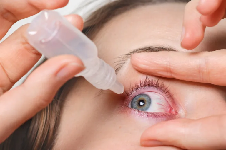 FDA approves Tarsus’ Xdemvy, the first treatment for a prevalent eyelid condition