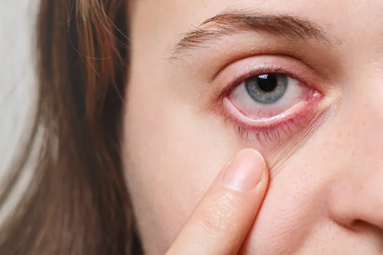 American Society of Retinal Specialists raise concerns regarding Apellis Pharmaceuticals’ Syfovre