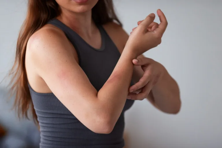 Pfizer Slashes Enrollment For Lyme Disease Trial Following CRO Trouble