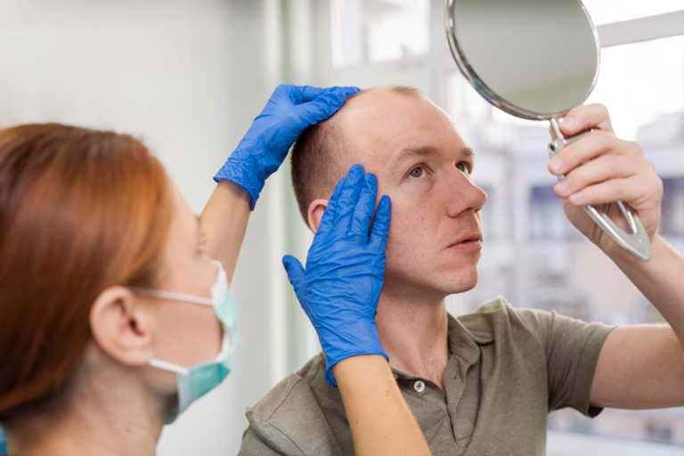 Soterios Achieves Phase 2 Success for Alopecia Cream as an Alternative to JAK Inhibitors