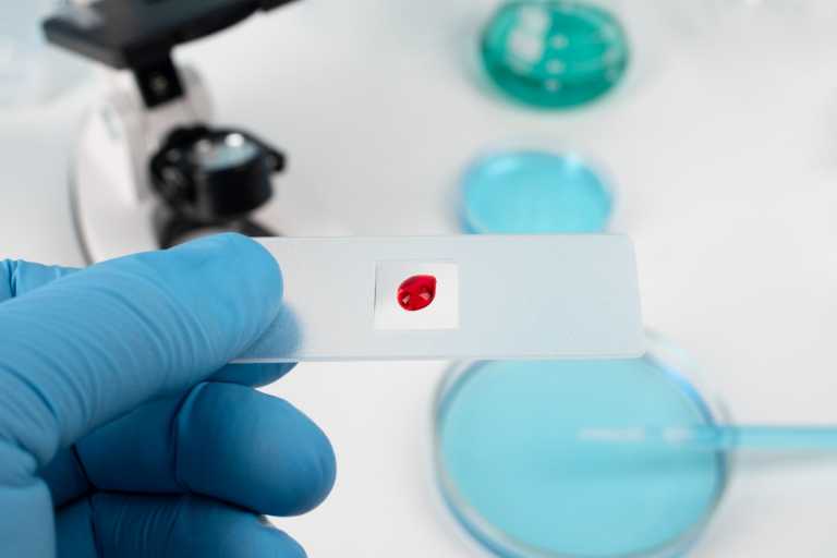 GSK Provides Insight Into Potential HIV Treatment Data