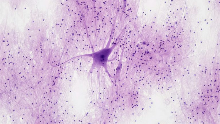 Seyltx Secures Option to License GluN2B Antagonists from NeurOp