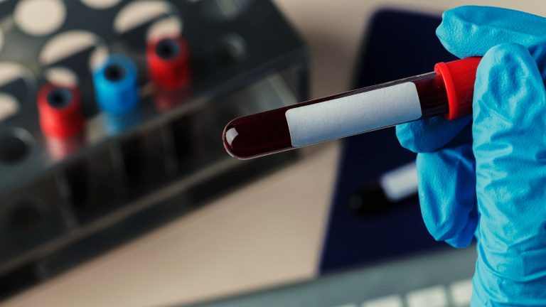 Cosentyx Misses Primary Endpoint in Phase III Giant Cell Arteritis Trial