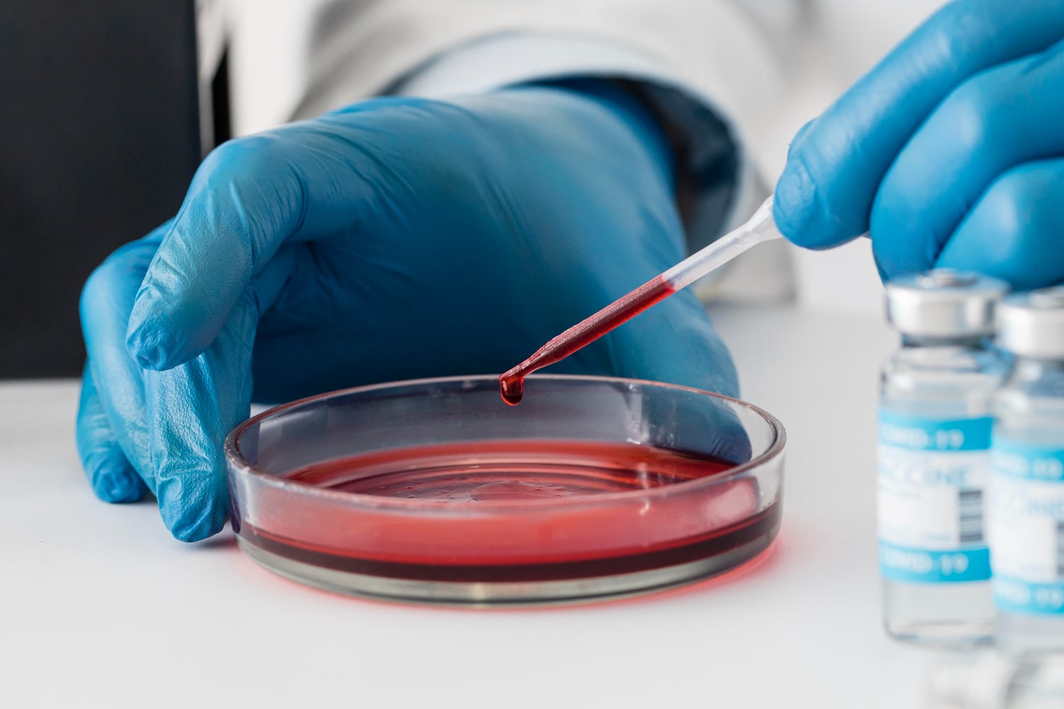 Bezuclastinib Meets Primary Endpoint in Phase 3 Trial for Systemic Mastocytosis